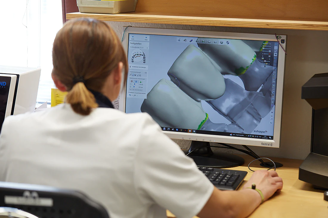 Dentallabor-Hannover-Zahntechnik-Schollmeier-2649 copy