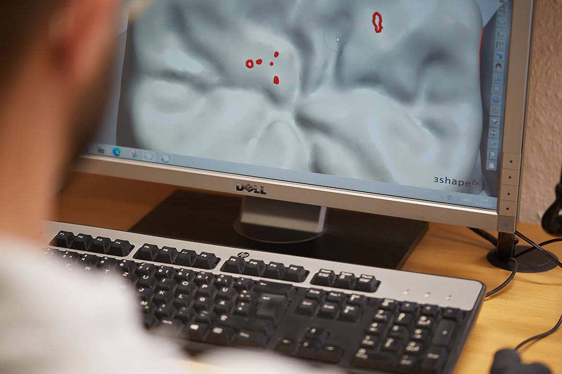 Dentallabor-Hannover-Zahntechnik-Schollmeier-2709 copy