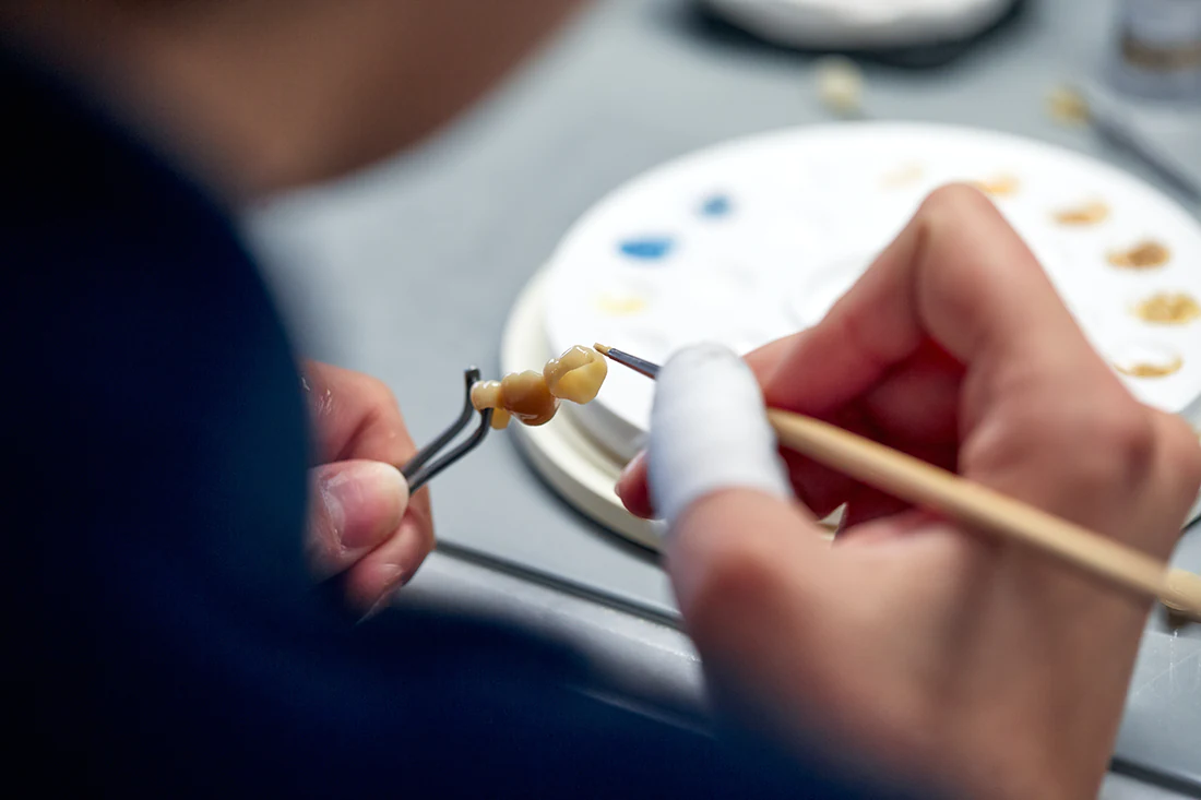 Dentallabor-Hannover-Zahntechnik-Schollmeier-2769