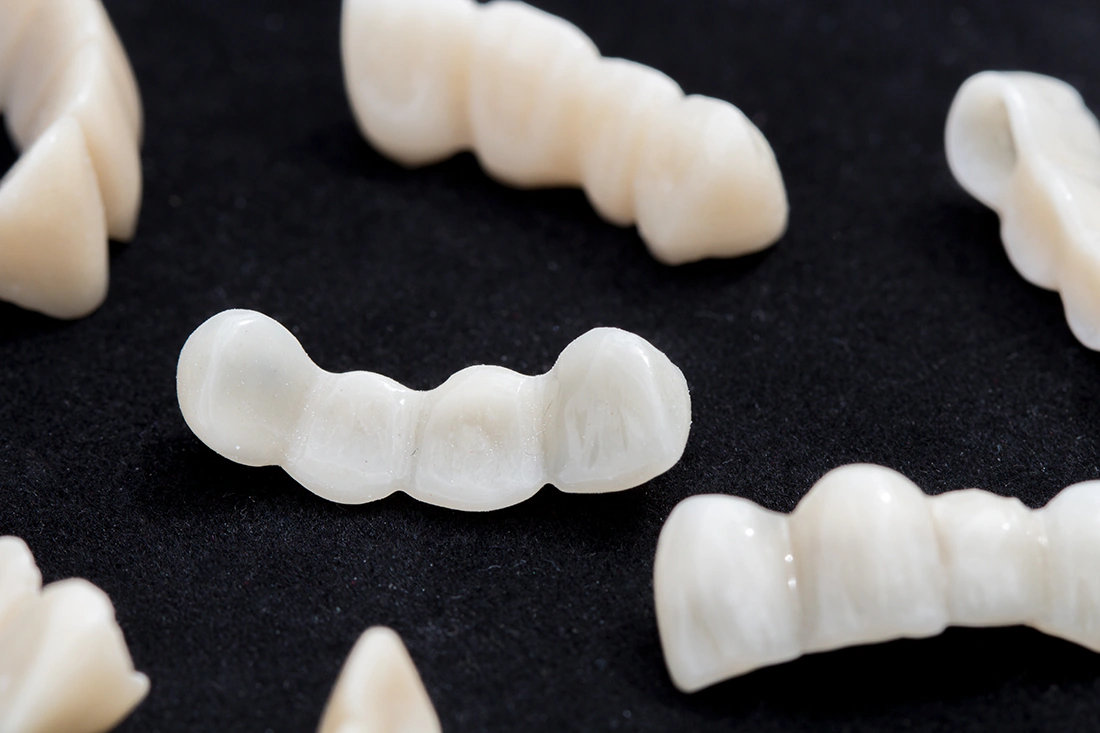 Langzeitprovisorien Schollmeier Dental - Hannover und deutschlandweit