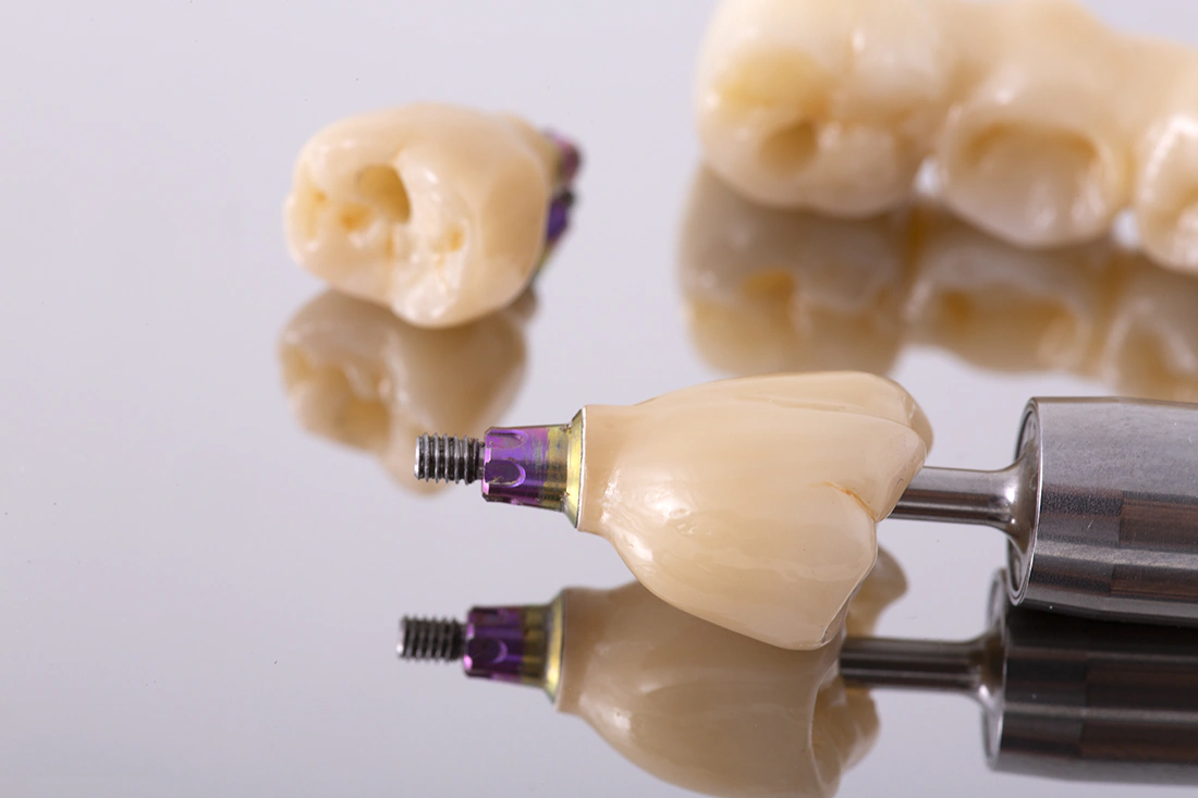 Straumann, Nobel Biocare, Camlog, Sirona - Schollmeier Dental